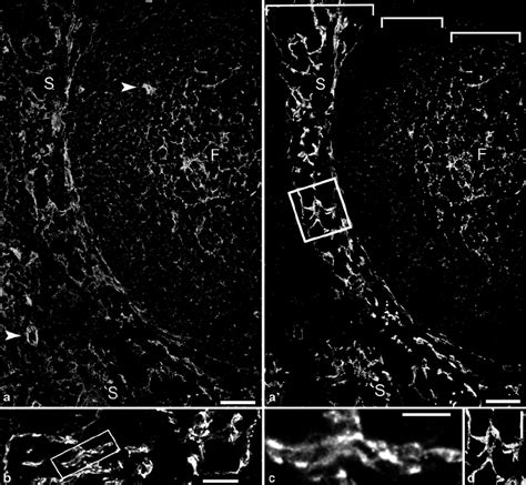 Double Label Laser Scanning Immunofluorescence Micrographs Of A