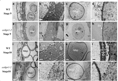 Transmission Electron Microscopy Tem Analysis Of Anthers Microspores