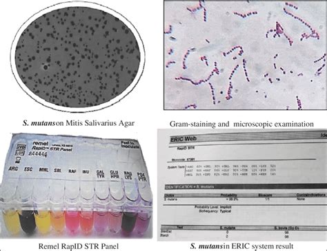 Photo 1 Isolation Identification And Selection Of Streptococcus