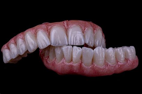 Fixed Zirconia Full Arch Teeth Express Detail Dental