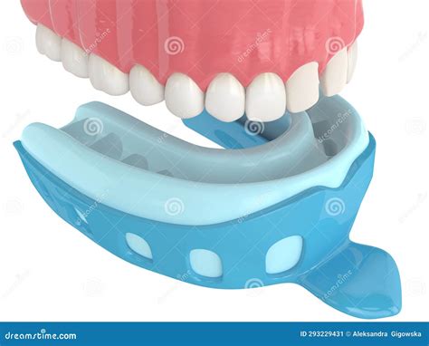 Mandibular Arch With Buccal Nerve Block Royalty Free Stock Image