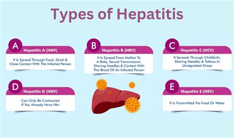 Hepatitis Symptoms Causes Treatment And Prevention 40 Off