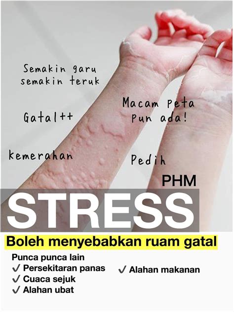 Stress Boleh Menyebabkan Ruam Gatal Pada Badan Sinar