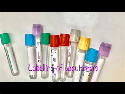 Pre Analytical Variables In Phlebotomy Identifying Blood Samples