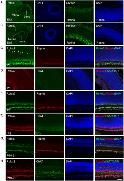 Expression Of Rbfox During Retina Differentiation Mouse Retinas At