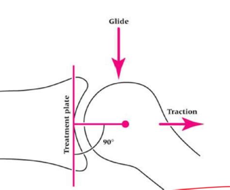 Week 2 Peripheral Joint Mobilization Flashcards Quizlet