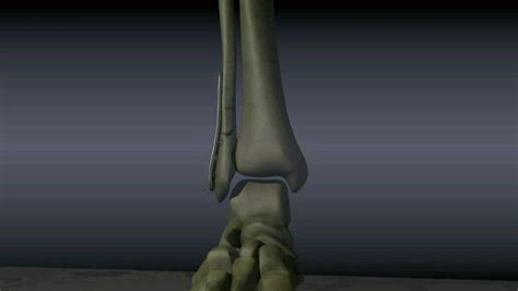 Surgical Treatment Of Ankle Fractures Youtube