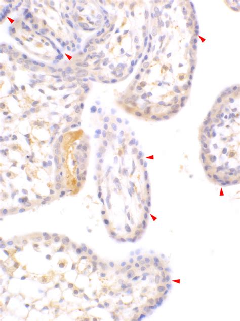 Immunohistochemical Visualization Of The Receptor Cx Cr In Perfused