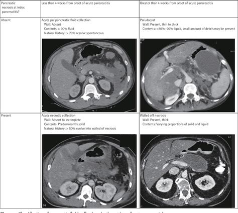 Figure 1 From The Role Of Endoscopic Therapy In The Minimally Invasive Management Of Pancreatic