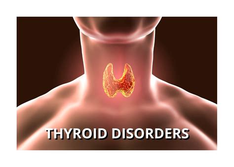 Thyroid Disorders District Endocrine