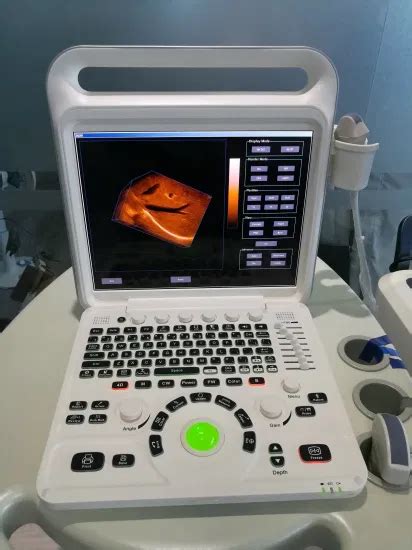 Most Cost Effective Portable Color Doppler Ultrasound Scanner