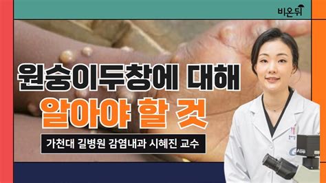 원숭이 두창 증상 원숭이두창에 대해 알아야 할 것 원숭이두창 동성 간 성관계 때문이 아니다 원숭이두창 딱지로 옮길 수