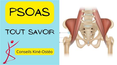 Qu est ce que l Ilio Psoas Tout comprendre sur ce muscle à la mode