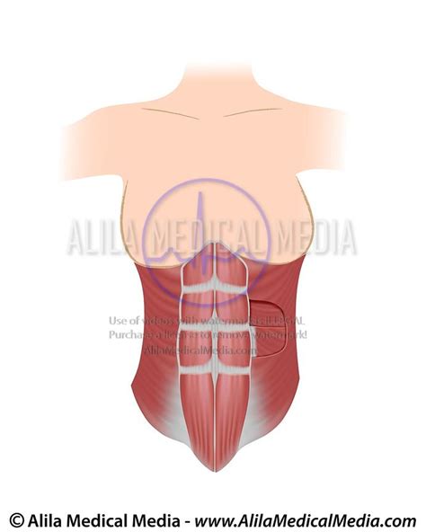 Alila Medical Media Bones Joints And Muscles Images