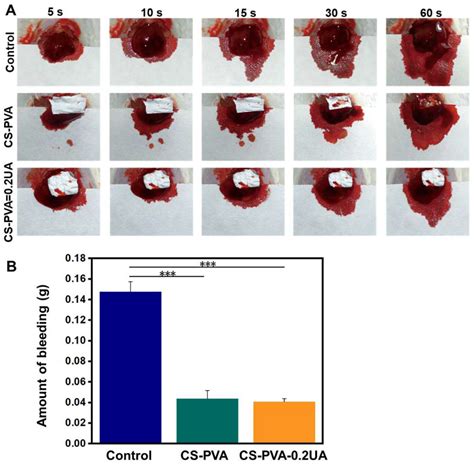 Nanomaterials Free Full Text Electrospun Chitosanpolyvinyl Alcohol Nanofiber Dressings