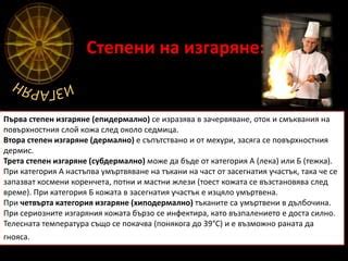 изгаряния | PPT