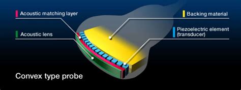 Why Does An Ultrasound Probe Need Matching Layers Probo Medical