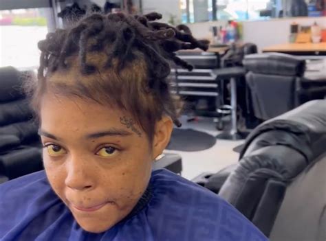 young mas health update  yellow eyes video  viral