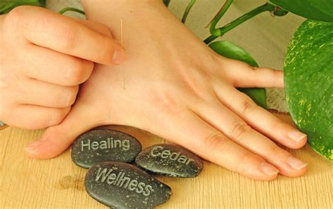 Healing Cedar Wellness Massage Acupuncture Port Moody Massage