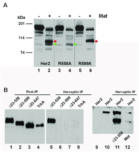 Matriptase Cleaved Her Ctfs Have Differential Interaction With