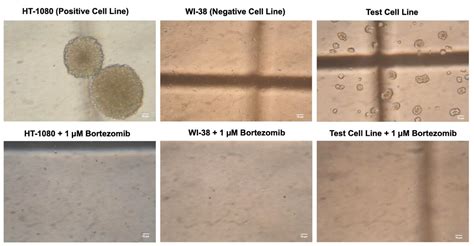 Soft Agar Colony Formation Assay Service Creative Bioarray