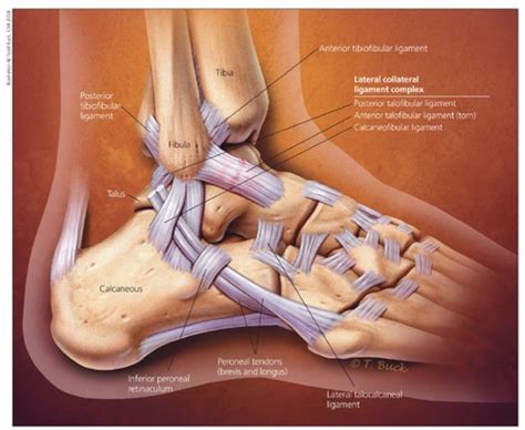 Ankle Ligament Surgery In Singapore Orion Ortho