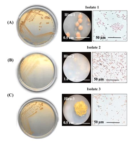 Isolation And Purification Of Marine Bacterial Isolates A B C