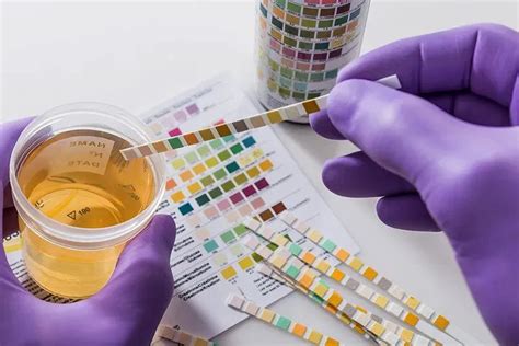 Urine Drug Test Guide: Purpose, Types- Australia Drug Testing