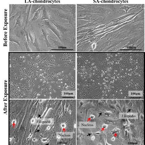 The Morphology Of Chondrocytes Before And After 3 Days Of Exposure To