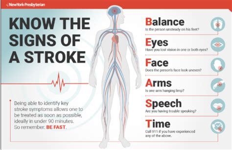 Stroke Flashcards Quizlet