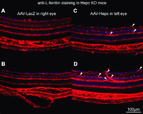 Ferritin Immunofluorescence In Aav Hepcidin Injected Retinas Download Scientific Diagram