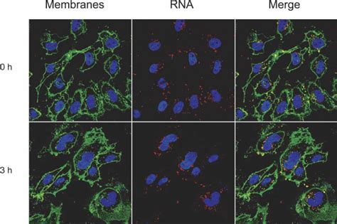 Confocal Microscopy Of Transfected Cells HeLa Cells Seeded In A