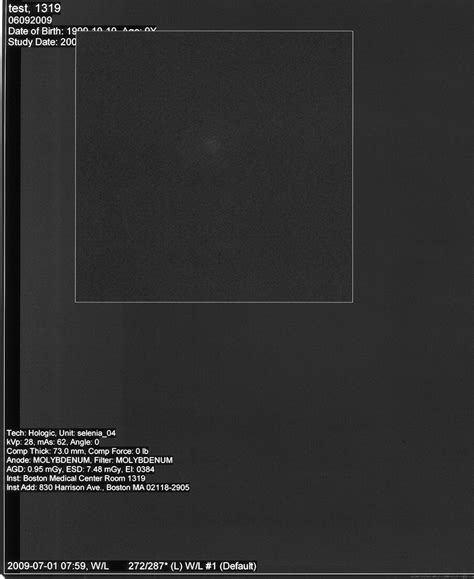 Optimizing Digital Mammographic Image Quality For Full Field Digital