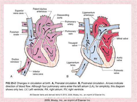 Peds Cardiac Dysfunction Flashcards Quizlet