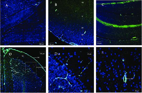 Representative Fluorescence Micrographs Of Plasminogen Immuno Labelling