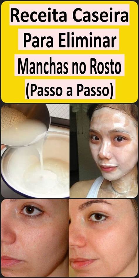 Receita Caseira Para Eliminar Manchas No Rosto Passo A Passo In