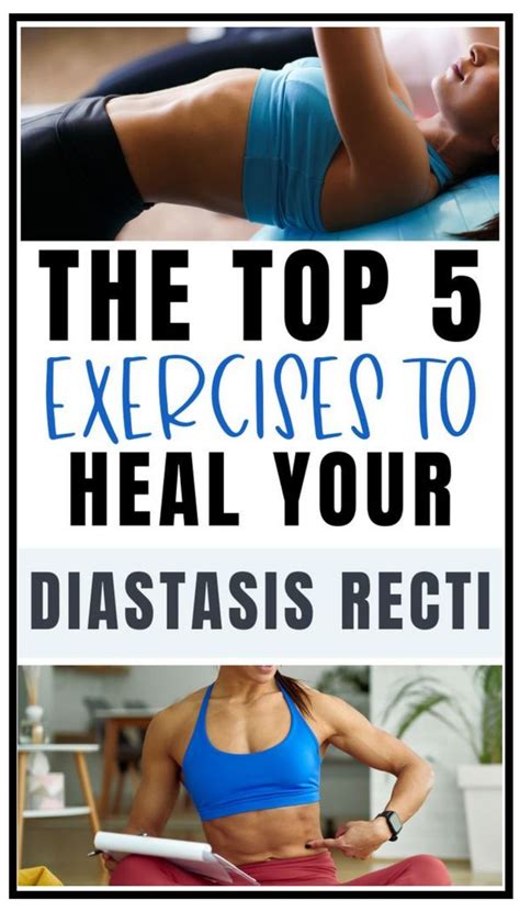 The Best Diastasis Recti Exercises To Repair Mommy Tummy Artofit