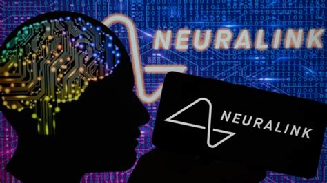 Musk anunció que se realizó primer implante de Neuralink