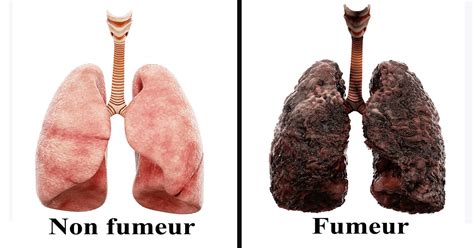 Les Conseils Pour Nettoyer Naturellement Les Poumons