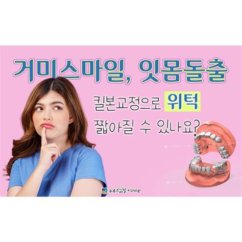 ﻿거미스마일 잇몸돌출 킬본교정으로 위턱 짧아질 수 있나요 부산센텀해운대교정치과 뉴욕스마일교정치과 부산센텀