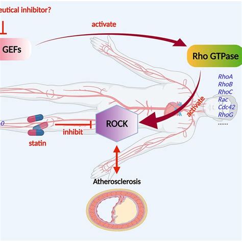 Pathology Of Atherosclerosis A Atherogenesis Stages B