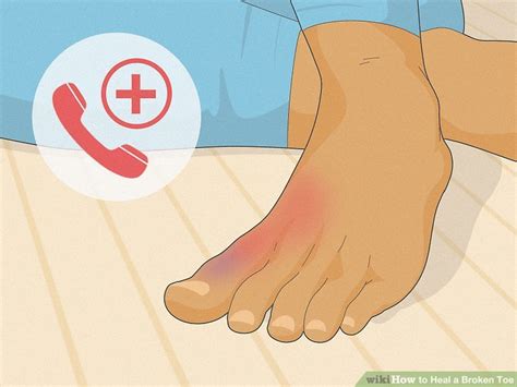 How To Heal A Broken Toe Steps With Pictures Wikihow