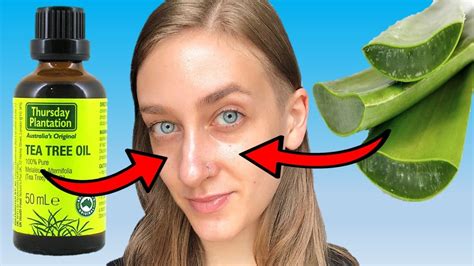 DIY Aloe Vera Tea Tree Oil Moisturizer For Oily Acne Prone Skin