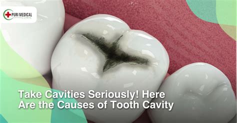 tooth cavity  learn    puri medical