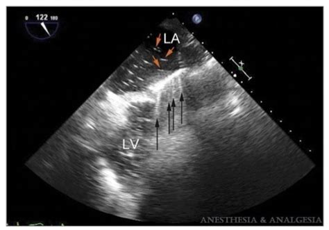 Principles Of Ultrasound OpenAnesthesia