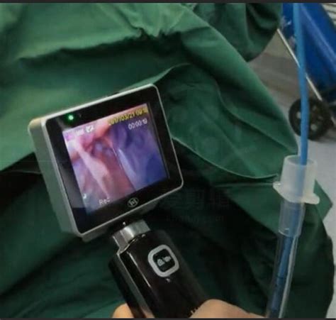 Icu Ems Single Use Intubation Video Laryngoscope With X Camera