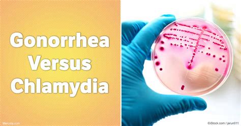 Gonorrhea Versus Chlamydia