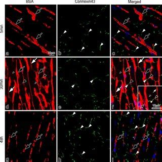 Confocal Laser Scanning Micrographs Of Double Immunofluorescence