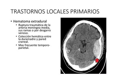 Traumatismo Craneoencefalico Pptx