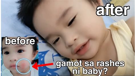 Gamot Sa Pula Pulang Mukha Ni Baby Gamot Sa Rashes Recommended By